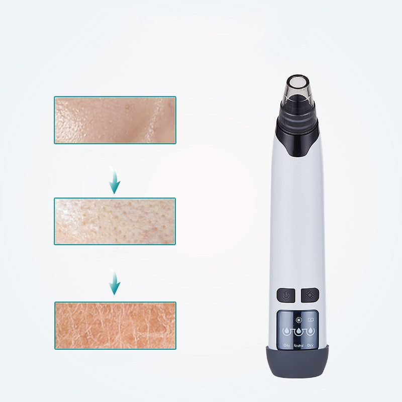 Heating electric blackhead detector