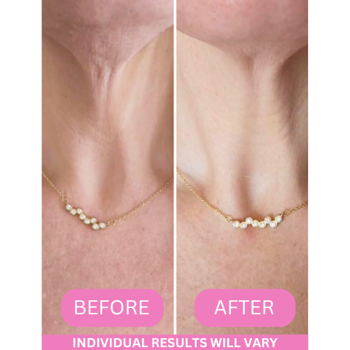 NeckLift Revive-Collagen - Anti-Wrinkle Neck Cream