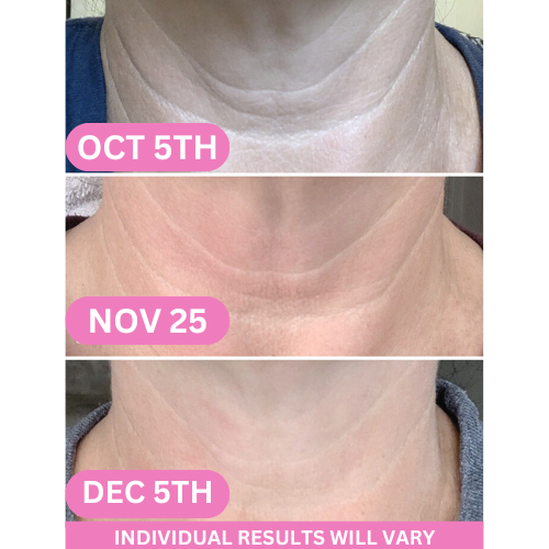 NeckLift Revive-Collagen - Anti-Wrinkle Neck Cream