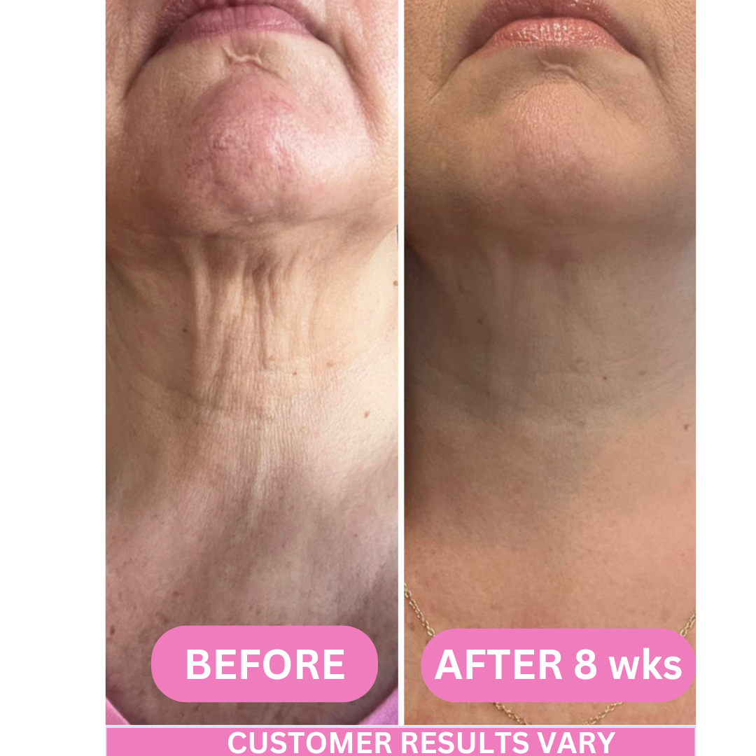 NeckLift Revive-Collagen - Anti-Wrinkle Neck Cream