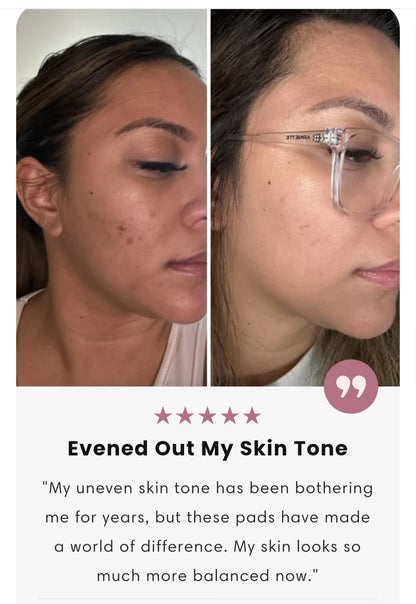 Pigment-B Gone: Tumeric & Kojic Serum